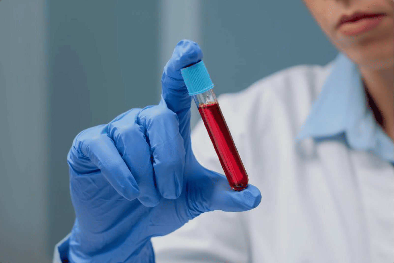 Why Thalassemia Screening Can’t Wait: A Vital Step for Health