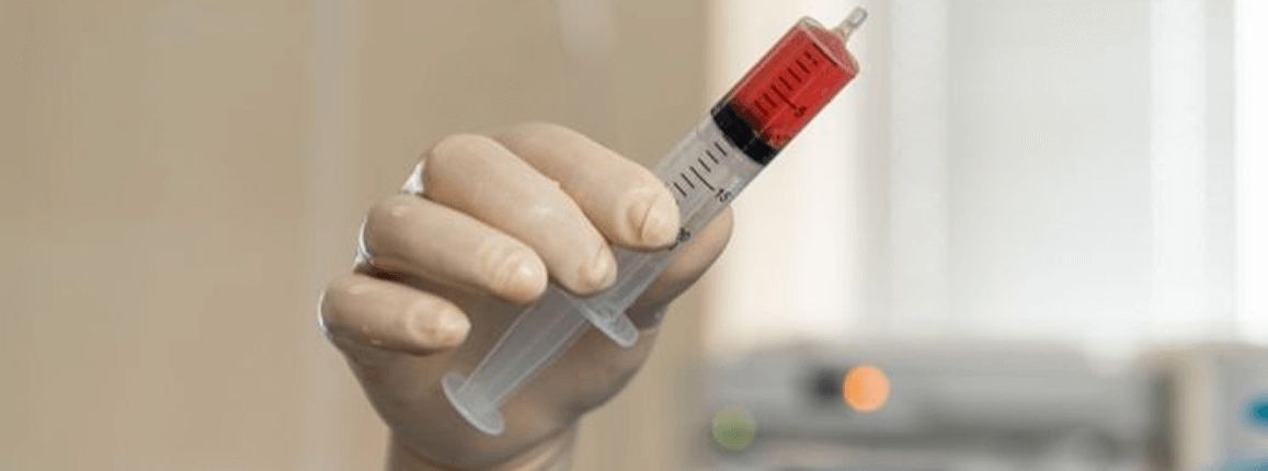 Bone Marrow Transplant